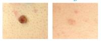 Clear Complexions Skin Therapy image 2